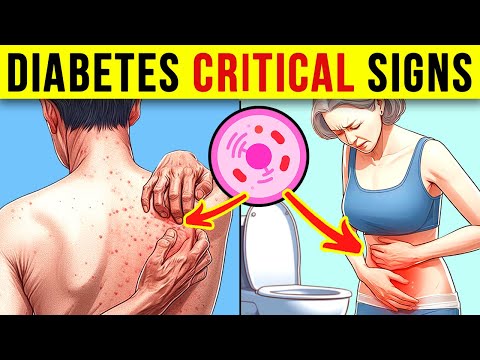 11 Distinct Symptoms That Your Blood Sugar Levels Are High (MUST WATCH)