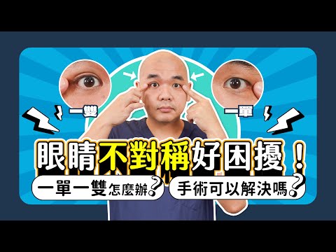 眼睛不對稱好困擾！一單一雙怎麼辦？可以只做單邊嗎？《葉氏一二三》｜凡登整形外科 葉亘耕醫師