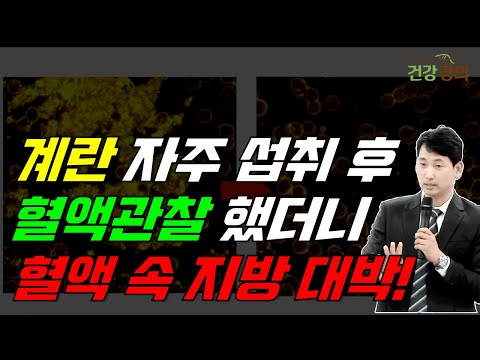 계란 자주 섭취후, 혈액 관찰했더니 지방 대박!