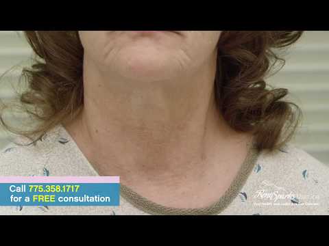 Platelet Rich Plasma for Neck Rejuvenation - Reno Sparks MedSpa - Dr. Calvin Van Reken