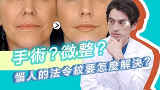 法令紋靠填充維持？有這些問題的人建議不要這樣做！｜玉貴人小教室｜隆鼻手術 鼻唇溝手術