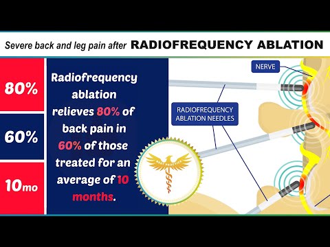 Neurosurgeon explains severe back or leg pain after RADIOFREQUENCY ABLATION