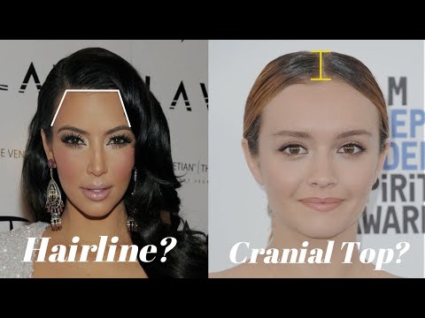 How does Hairline & Cranial Top affect Hairstyles?