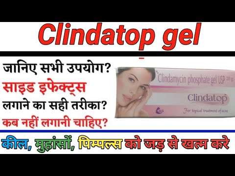 How to use Clindatop Gel , how to apply clindatop gel #cngajbhiye #clintopgel #clindatop