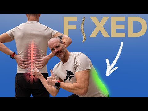 How I Fixed My Bad Back In 5 Steps