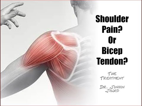 Shoulder Pain or Bicep Tendon Pain?  The Treatment -- Part 2