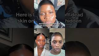 #clearskinjourney #skincaretips #skincareroutine #skincares #short #shortvideo