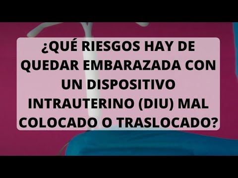 ¿Qué riesgos hay de quedar embarazada con un dispositivo intrauterino mal colocado o traslocado?