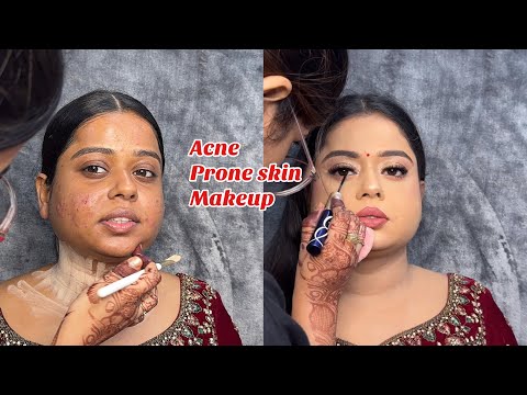 ACNE PRONE SKIN MAKEUP TUTORIAL ✅ REAL BRIDAL MAKEUP