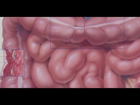 Is The Colon Really Lumpy?