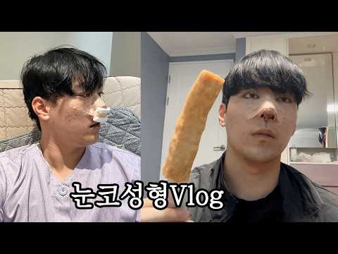 남자 성형 고민이라면 필수 시청💥 효과 미쳤다 진짜..😲 [도준67Vlog]