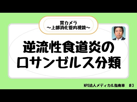 逆流性食道炎のよく分かる分類　～ ロサンゼルス（LA）分類 ～