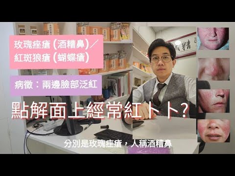 點解面上經常紅卜卜？