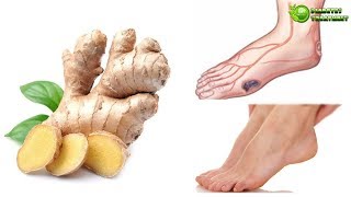 Can a Diabetic Eat Ginger –Ginger Is Good Or Bad For Diabetes?