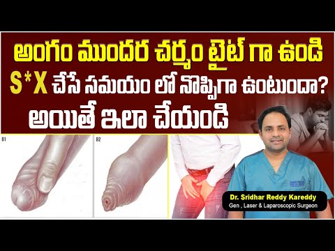 How to Loose Tight Foreskin || Symptoms of Balanitis and Balanoposthitis || Treatment Range Hospital