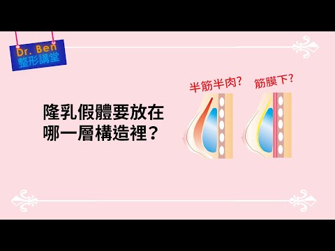 隆乳假體該怎麼放？你不知道的隆乳訣竅【Dr. Ben整形講堂】