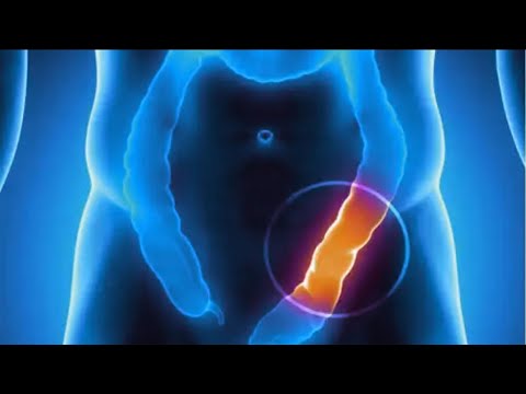 8 things you need to know about the large intestine | Natural Health