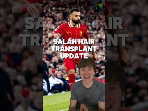 MO SALAH HAIR TRANSPLANT UPDATE 🔥