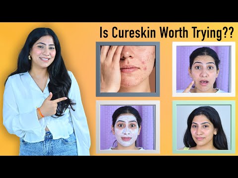 My Skincare Journey - Experiences/Mistakes #cureskin #cureskinapp #cureskinreview