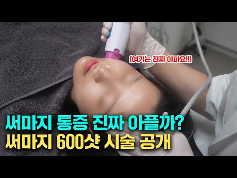 얼굴탄력 리프팅 끝판왕 써마지 600샷 실제 시술 장면 공개!!