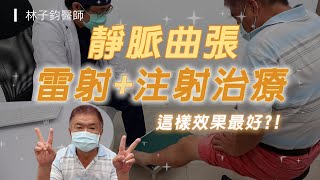 久站造成嚴重靜脈曲張 ? ! 雷射+注射治療、雙管齊下效果最好-極緻美型·文心極緻美型皮膚科診所整形手術-林子鈞醫師：靜脈曲張_台中靜脈曲張_硬化劑_雷射治療_注射治療