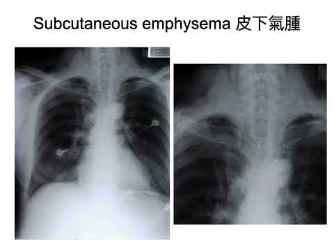 20230927 respiratory system part2