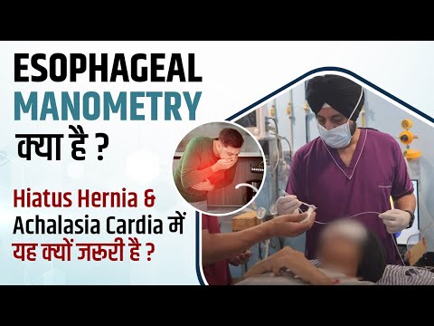 What is Esophageal manometry? Esophageal Manometry Test Procedure Explained In Hindi