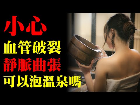 靜脈曲張可以泡溫泉嗎？｜許原彰醫師：台中，高雄，台南，台北，新竹，靜脈曲張專家