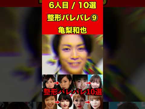 亀梨和也⑨整形がバレバレな芸能人！10選 #芸能界の闇 #ゴシップ #整形 #芸能人 #噂話 #有名人  #雑学 #モデル #芸能 #女優 #アイドル #美容