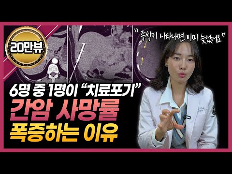 간암 사망률이 계속 늘어나는 이유! | 간 안 좋을 때 반드시 피해야 할 3가지! | 간 지키는 습관