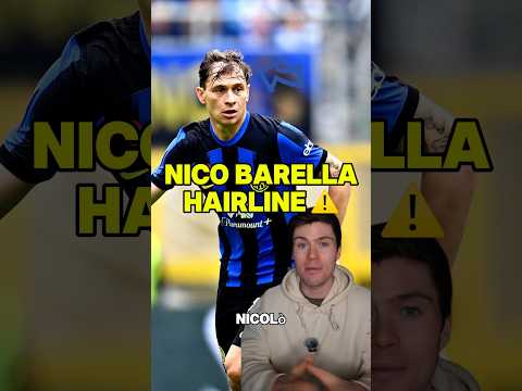 NICO BARELLA’S HAIRLINE IS BACK! ⚠️