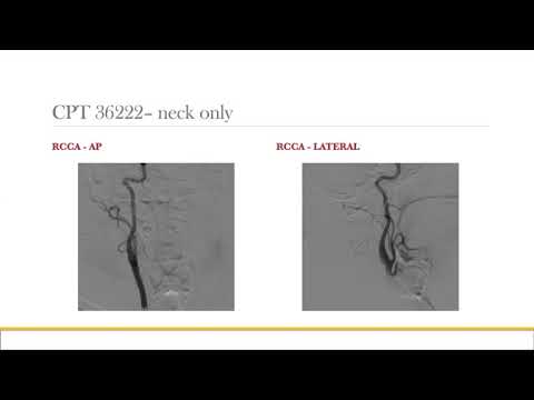 AANS Coding Shorts: Basic Endovascular Coding Concepts