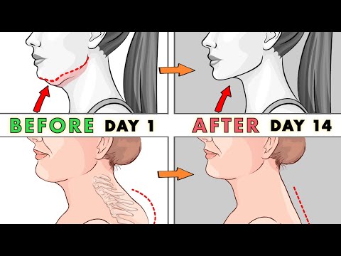 Double chin + Neck hump + Laugh Lines | Look 10 Years Younger, Tighten Your Skin (Subtitle)