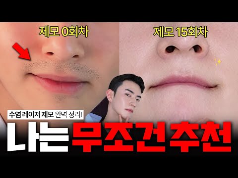 수염자국만 없어도 최소 5년은 어려보입니다🧔➡️🧑 (레이저 제모 완벽 정리)