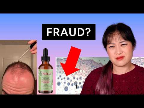 Rosemary oil for hair loss? Scam like a scientist