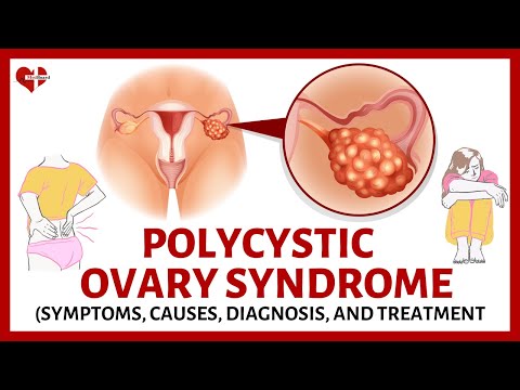 What is Polycystic Ovary Syndrome (PCOS) ? | PCOS Made Easy