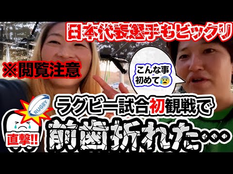 【ラグビー日本代表🏉🇺🇸】初めてお友達のラグビーの試合観戦に行ったら歯が折れたよ😱自分が悪いけど・・・