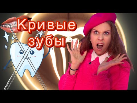 Хейт, кривые зубы, осуждения, боль. Моя история брекетов. Почему я сделала бы снова #катяклон