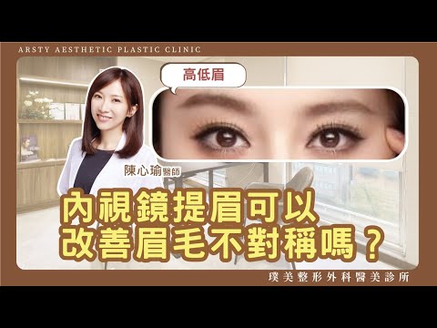 內視鏡提眉可以改善眉毛不對稱嗎？#璞美#陳心瑜醫師#提眉#拉皮#高低眉