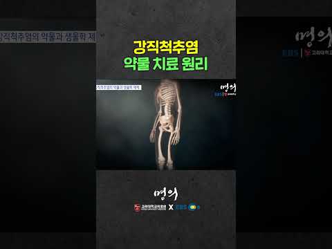 MZ남성 잘 걸리는 강직척추염 약물 치료 원리