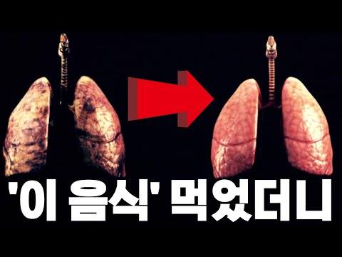 '이 음식들' 먹었더니 죽어가던 폐가 살아났다. 폐에좋은음식