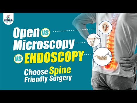 Open Vs. Microscopic Vs. Endoscopic | Which is the Best Surgery for Your Spine | Healing Hospital