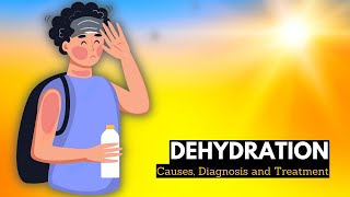 What is Dehydration? Causes, Signs and Symptoms, Diagnosis and Treatment.