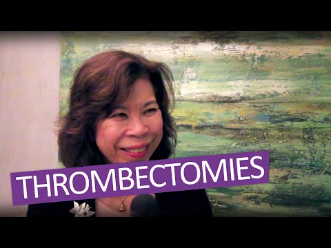 Who should perform thrombectomies?