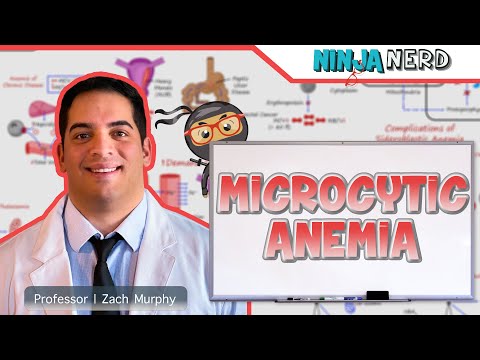 Microcytic Anemia | Clinical Medicine