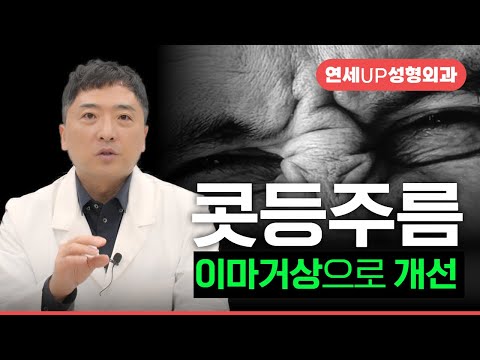 깊은 콧등주름 이마거상으로 개선할 수 있습니다 | 중년 얼굴주름 관리 - 연세UP성형외과