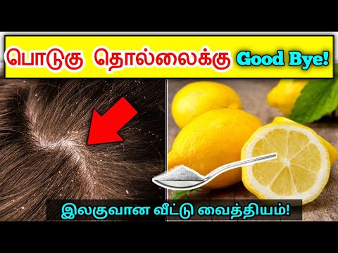 பொடுகு தொல்லைக்கு Good bye! | Natural home remedy for dandruff in tamil | Dandruff home remedy tamil