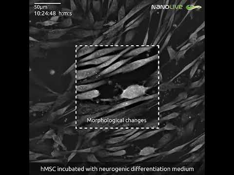 Stem cell differentiation into neuronal cells