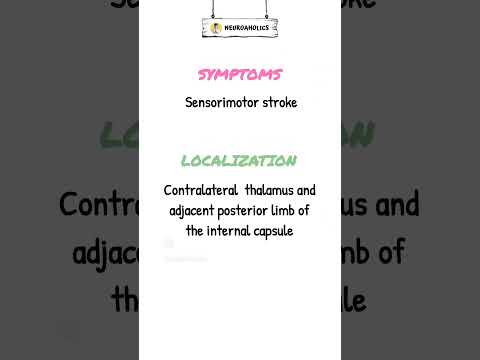 Lacunar Syndromes Localization #shorts #youtubeshorts #stroke