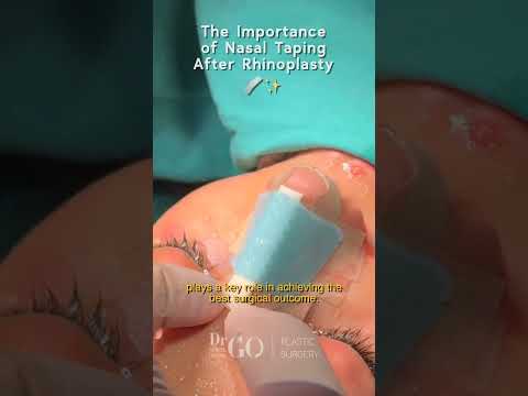 The Importance of Nasal Taping After Rhinoplasty